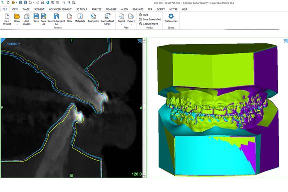 Virtuele weergave van tanden op een computerscherm.